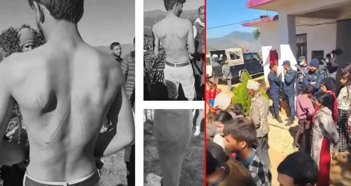 प्रहरी चौकी जम्बुकाँधका इन्चार्ज ठकुरी विवादमा, तीन युवालाई कुटपिट गरेको आरोप